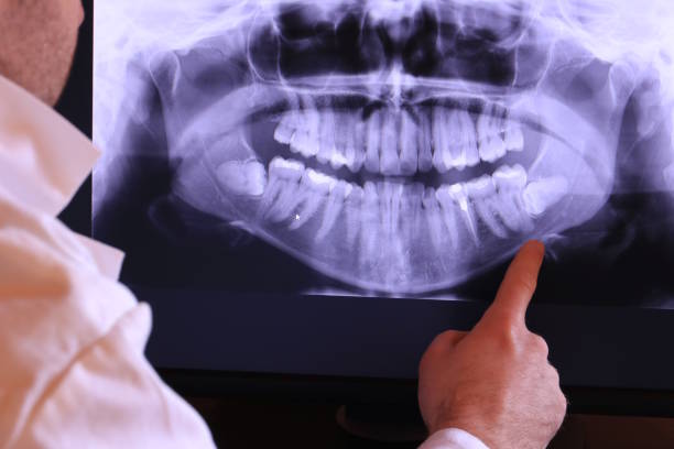 Best Emergency Dental Care for Broken or Chipped Teeth in Champion Heights, OH