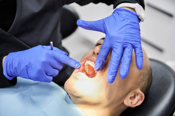 Best Emergency Treatment for Dental Infections or Abscesses in Champion Heights, OH
