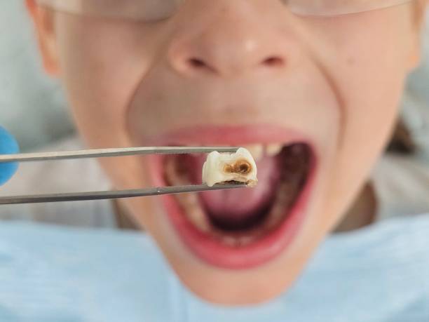 Best Same-Day Emergency Dental Services in Champion Heights, OH
