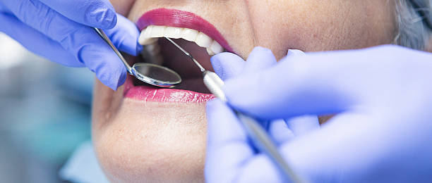 Best Emergency Tooth Extraction in Champion Heights, OH